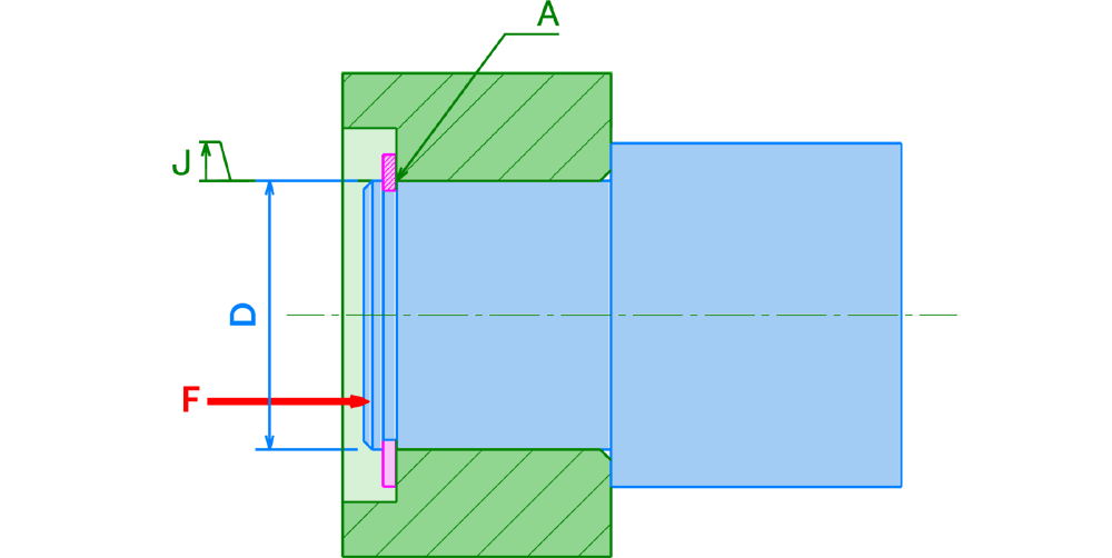 Implantation anneau élastique extérieur